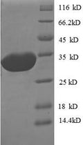 Recombinant Escherichia coli O157:H7 Peptide deformylase (def) – Figure 1 of 1