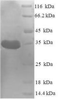 Recombinant Staphylococcus aureus Peptide deformylase (def) – Figure 1 of 1
