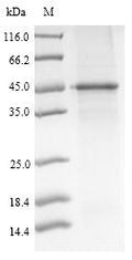 (Tris-Glycine gel) Discontinuous SDS-PAGE (reduced) with 5% enrichment gel and 15% separation gel.