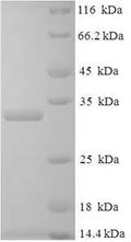 Recombinant Human Placenta growth factor (PGF) – Figure 1 of 1