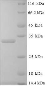 Recombinant Human Placenta growth factor (PGF) – Figure 1 of 1