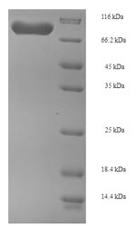 Recombinant Human Phosphoglucomutase-1 (PGM1) – Figure 1 of 1