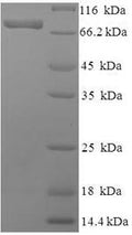 Recombinant Human Phosphoacetylglucosamine mutase (PGM3) – Figure 1 of 1