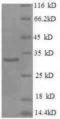 Recombinant Human Prohibitin (PHB) – Figure 1 of 1