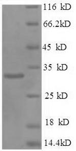 Recombinant Human Prohibitin (PHB) – Figure 1 of 1