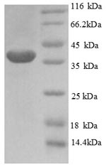 Recombinant Human PHD finger-like domain-containing protein 5A (PHF5A) – Figure 1 of 1