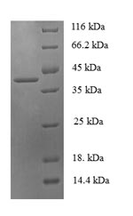 Recombinant Human 14KDA phosphohistidine phosphatase (PHPT1) – Figure 1 of 1