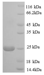 Recombinant Bovine Polymeric immunoglobulin receptor (PIGR), partial – Figure 1 of 1
