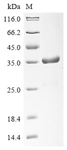 (Tris-Glycine gel) Discontinuous SDS-PAGE (reduced) with 5% enrichment gel and 15% separation gel.