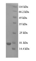 Recombinant Human Prolactin-inducible protein (PIP) – Figure 1 of 1