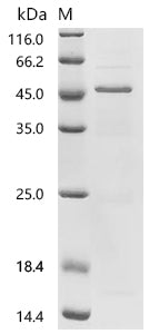 (Tris-Glycine gel) Discontinuous SDS-PAGE (reduced) with 5% enrichment gel and 15% separation gel.