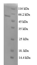 Recombinant Mouse Pituitary homeobox 3 (Pitx3) – Figure 1 of 1