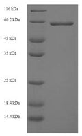 Recombinant Human Pyruvate kinase PKLR (PKLR) – Figure 1 of 1