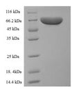 Recombinant Rat Pyruvate kinase isozymes R/L (Pklr) – Figure 1 of 1