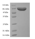Recombinant Rat Pyruvate kinase isozymes R/L (Pklr) – Figure 1 of 1