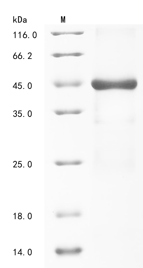 (Tris-Glycine gel) Discontinuous SDS-PAGE (reduced) with 5% enrichment gel and 15% separation gel.