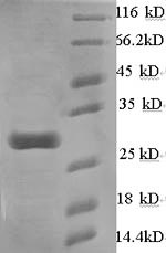 Recombinant Mouse Calcium-dependent phospholipase A2 (Pla2g5) – Figure 1 of 1