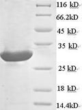 Recombinant Rat Calcium-dependent phospholipase A2 (Pla2g5) – Figure 1 of 1