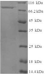 Recombinant Human Tissue-type plasminogen activator (PLAT), partial – Figure 1 of 1
