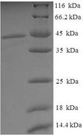 Recombinant Human Tissue-type plasminogen activator (PLAT), partial – Figure 1 of 1