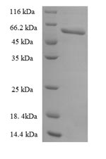 Recombinant Human Urokinase plasminogen activator surface receptor (PLAUR) – Figure 1 of 1
