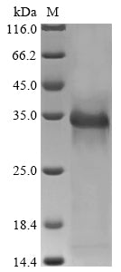 Recombinant Rat Urokinase plasminogen activator surface receptor (Plaur) – Figure 1 of 1