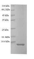 Recombinant Oncorhynchus mykiss Myelin proteolipid protein (plp), partial – Figure 1 of 1