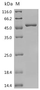 (Tris-Glycine gel) Discontinuous SDS-PAGE (reduced) with 5% enrichment gel and 15% separation gel.