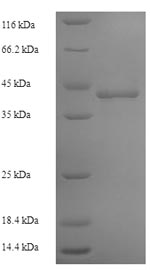 Recombinant Human DNA-directed RNA polymerase III subunit RPC1 (POLR3A), partial – Figure 1 of 1