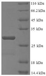Recombinant Human DNA-directed RNA polymerase III subunit RPC10 (POLR3K) – Figure 1 of 1