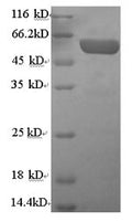 Recombinant Human Serum paraoxonase/arylesterase 1 (PON1) – Figure 1 of 1