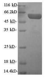 Recombinant Human Serum paraoxonase/arylesterase 1 (PON1) – Figure 1 of 1