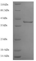 Recombinant Human Ribonuclease P protein subunit p29 (POP4) – Figure 1 of 1
