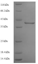 Recombinant Human Ribonuclease P protein subunit p29 (POP4) – Figure 1 of 1