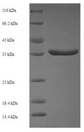 Recombinant Human Protein phosphatase 1B (PPM1B) – Figure 1 of 1