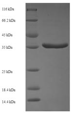 Recombinant Human Protein phosphatase 1B (PPM1B) – Figure 1 of 1