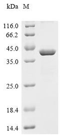 (Tris-Glycine gel) Discontinuous SDS-PAGE (reduced) with 5% enrichment gel and 15% separation gel.