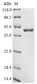 (Tris-Glycine gel) Discontinuous SDS-PAGE (reduced) with 5% enrichment gel and 15% separation gel.