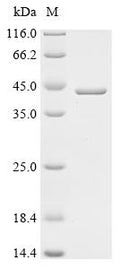 (Tris-Glycine gel) Discontinuous SDS-PAGE (reduced) with 5% enrichment gel and 15% separation gel.