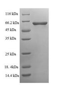 Recombinant Human Serine/threonine-protein phosphatase 2B catalytic subunit gamma isoform (PPP3CC), partial – Figure 1 of 1