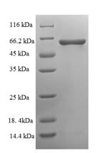 Recombinant Human Serine/threonine-protein phosphatase 2B catalytic subunit gamma isoform (PPP3CC), partial – Figure 1 of 1