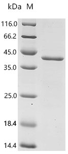 (Tris-Glycine gel) Discontinuous SDS-PAGE (reduced) with 5% enrichment gel and 15% separation gel.