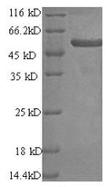 Recombinant Human Melanoma antigen preferentially expressed in tumors (PRAME) – Figure 1 of 1