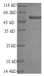 Recombinant Human Melanoma antigen preferentially expressed in tumors (PRAME) – Figure 1 of 1