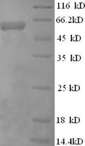 Recombinant Human Perforin-1 (PRF1) – Figure 1 of 1