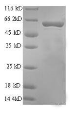 Recombinant Rat Perforin-1 (Prf1), partial – Figure 1 of 1