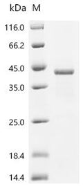 (Tris-Glycine gel) Discontinuous SDS-PAGE (reduced) with 5% enrichment gel and 15% separation gel.