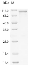 (Tris-Glycine gel) Discontinuous SDS-PAGE (reduced) with 5% enrichment gel and 15% separation gel.