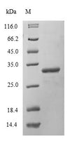 Recombinant Mouse DNA-dependent protein kinase catalytic subunit (Prkdc), partial – Figure 1 of 1