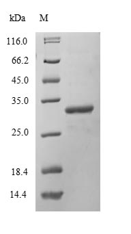 Recombinant Mouse DNA-dependent protein kinase catalytic subunit (Prkdc), partial – Figure 1 of 1